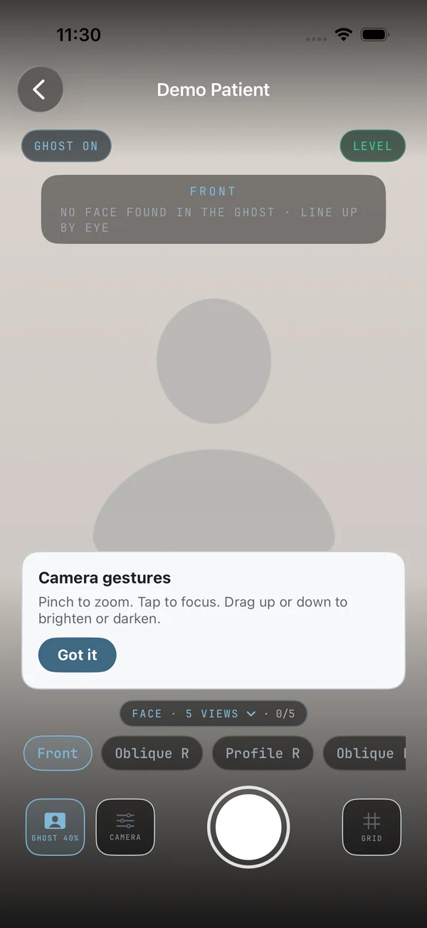 Capture screen with ghost overlay, level pill, series chips and shutter